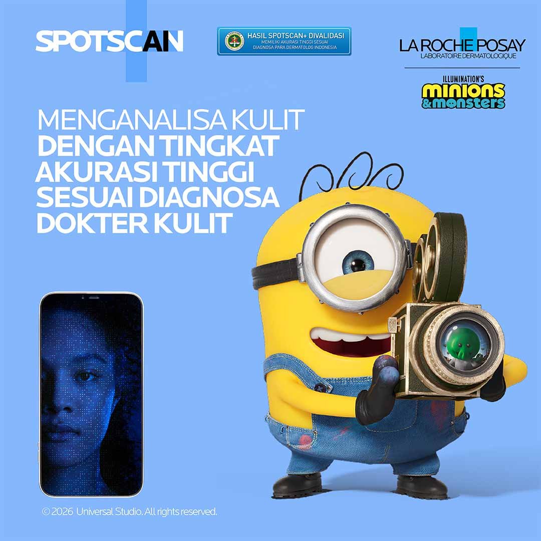 Spotscan Minion and Monsters